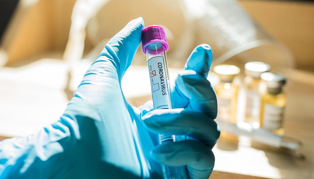 Africa’s confirmed COVID-19 cases pass 2.15 million mark: Africa CDC