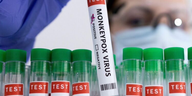 Authorities in Congo Approve New Vaccines to Combat Mpox Surge