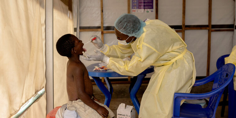 South Africa Enhances Health Screenings Following WHO’s Declaration of Mpox