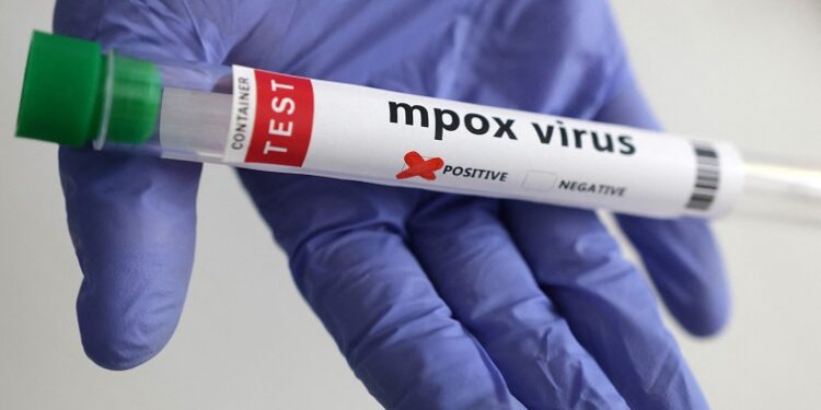 Zambia Confirms Mpox Case as New Variant Raises Regional Health Concerns