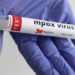 Zambia Confirms Mpox Case as New Variant Raises Regional Health Concerns