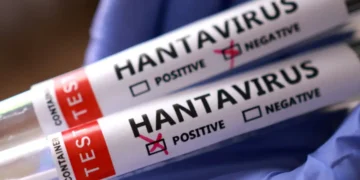 South Africa Monitors 97 Contacts Linked to Cruise Ship Hantavirus Cases