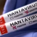 South Africa Monitors 97 Contacts Linked to Cruise Ship Hantavirus Cases